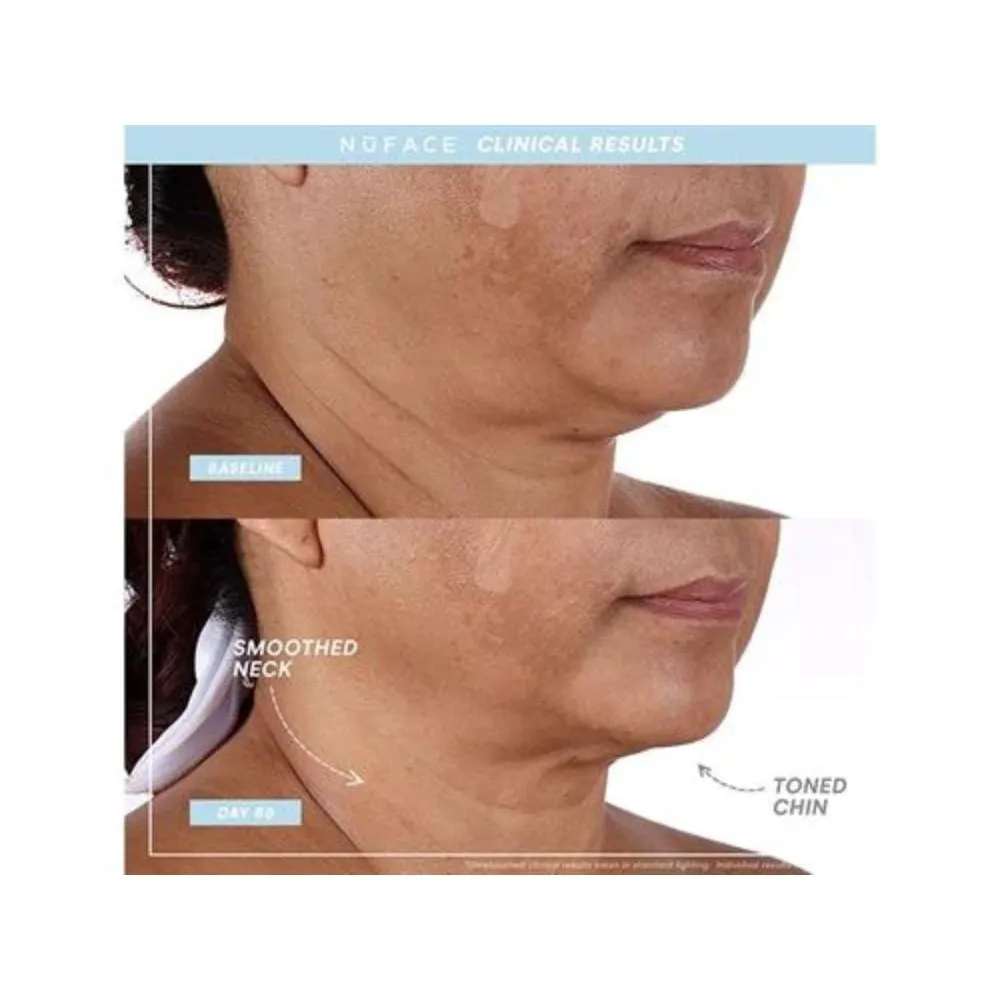 NuFACE TRINITY  PRO Starter Kit